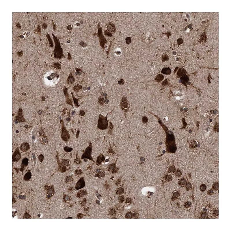 Atlas Antibodies Anti-FXR2 Antibody