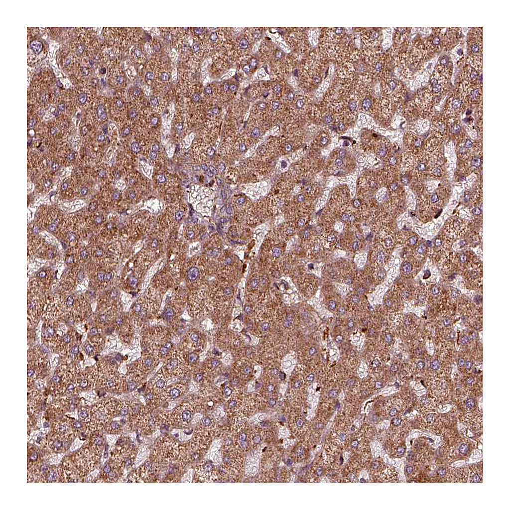 Atlas Antibodies Anti-FXN Antibody