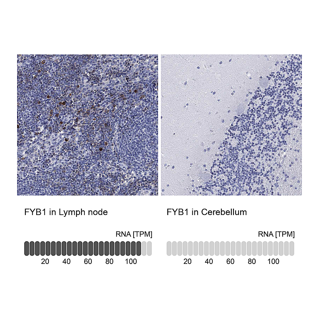 Atlas Antibodies Anti-FYB1 Antibody