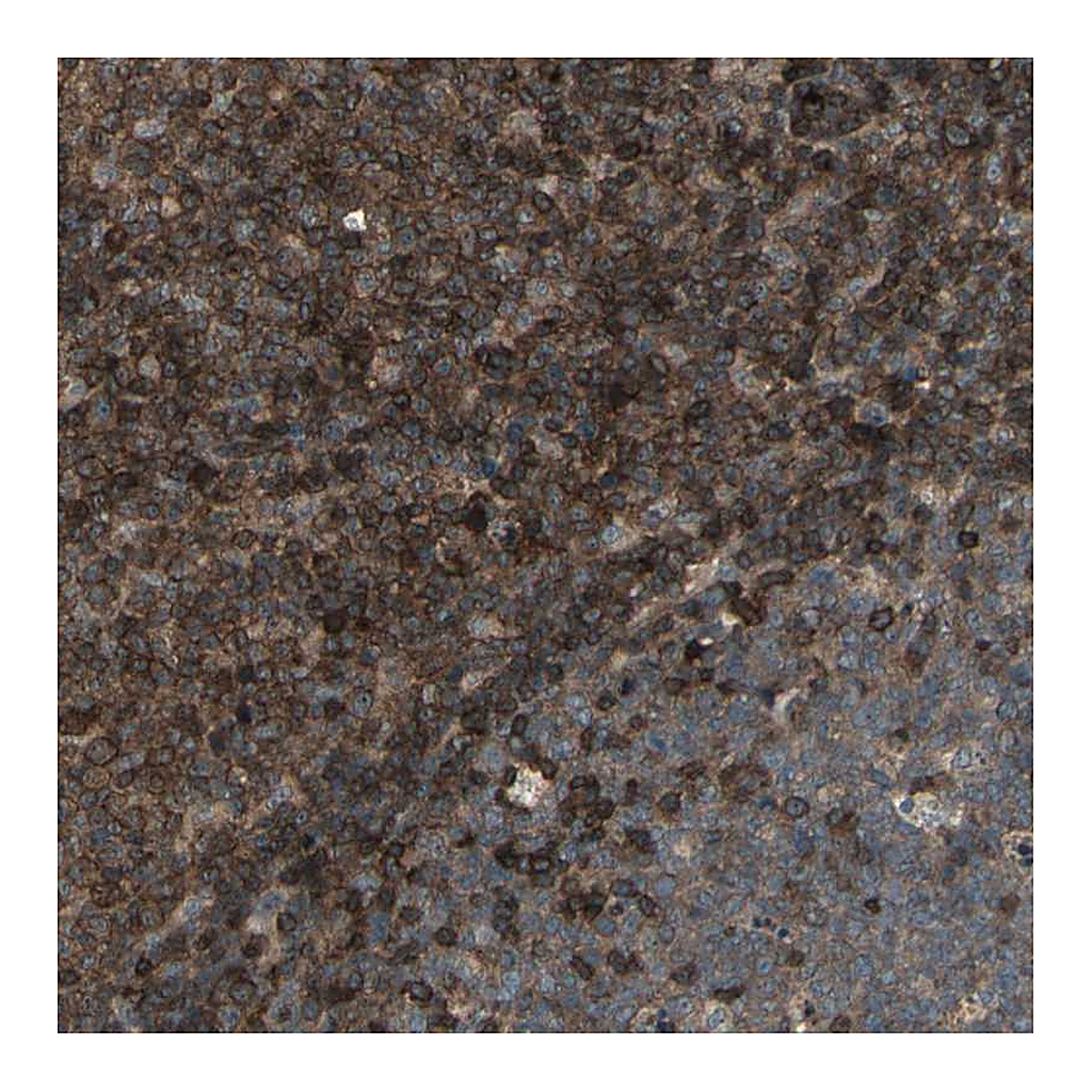 Atlas Antibodies Anti-FXYD5 Antibody