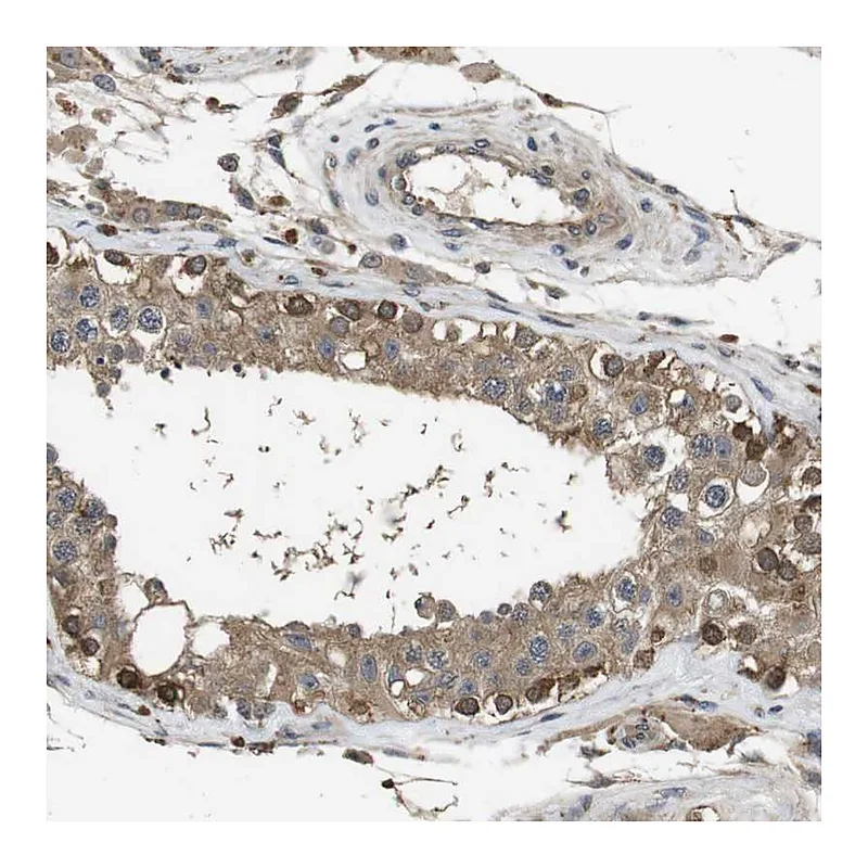 Atlas Antibodies Anti-FZD10 Antibody