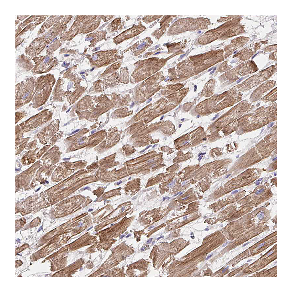 Atlas Antibodies Anti-FZD2 Antibody