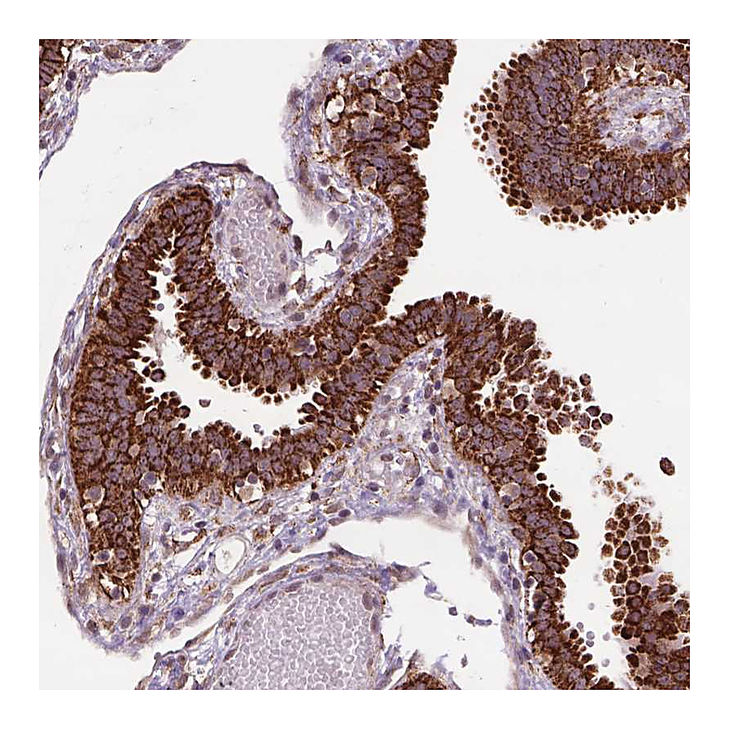 Atlas Antibodies Anti-FZD7 Antibody