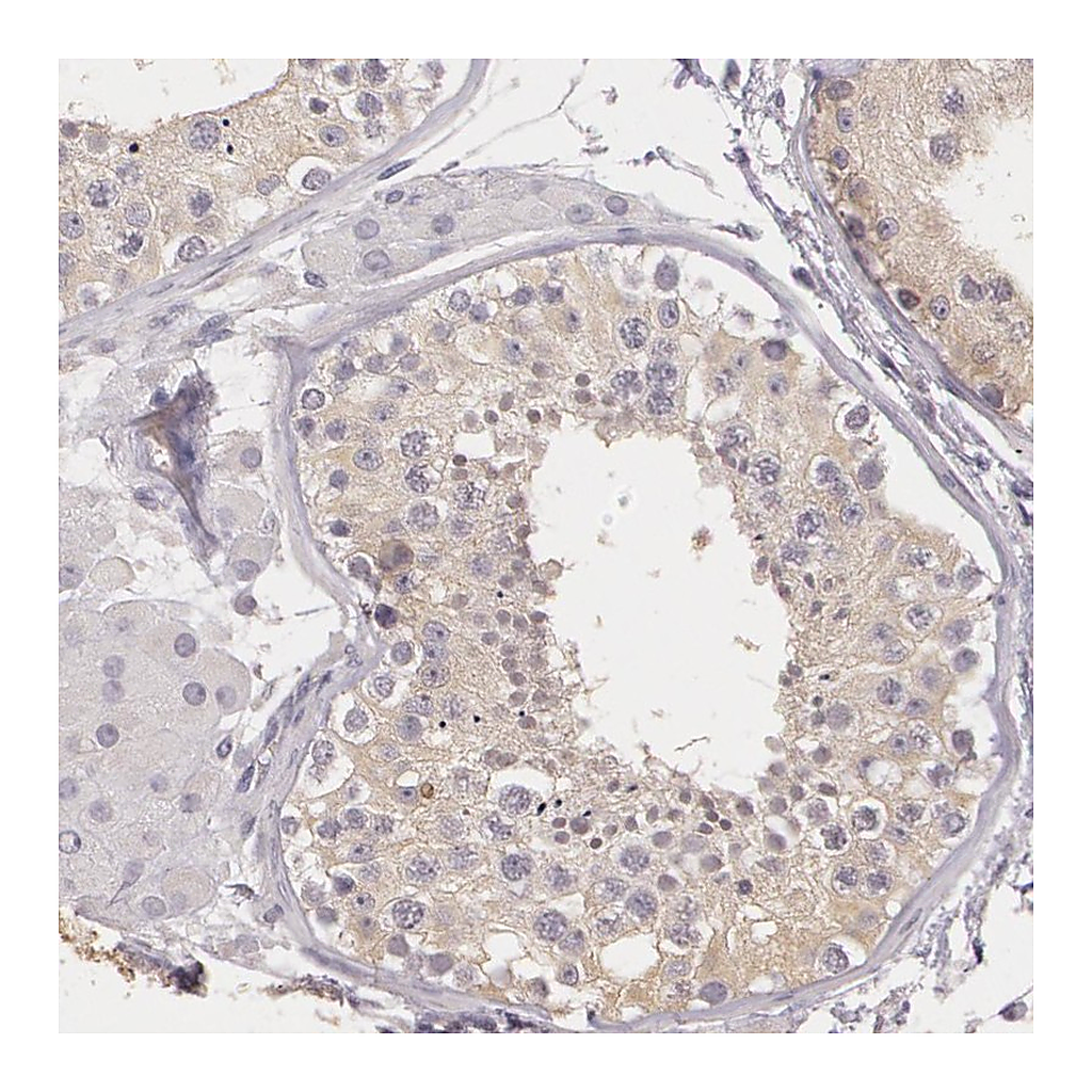 Atlas Antibodies Anti-G2E3 Antibody