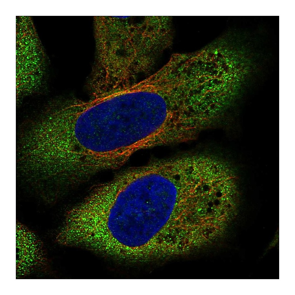 Atlas Antibodies Anti-FZD8 Antibody