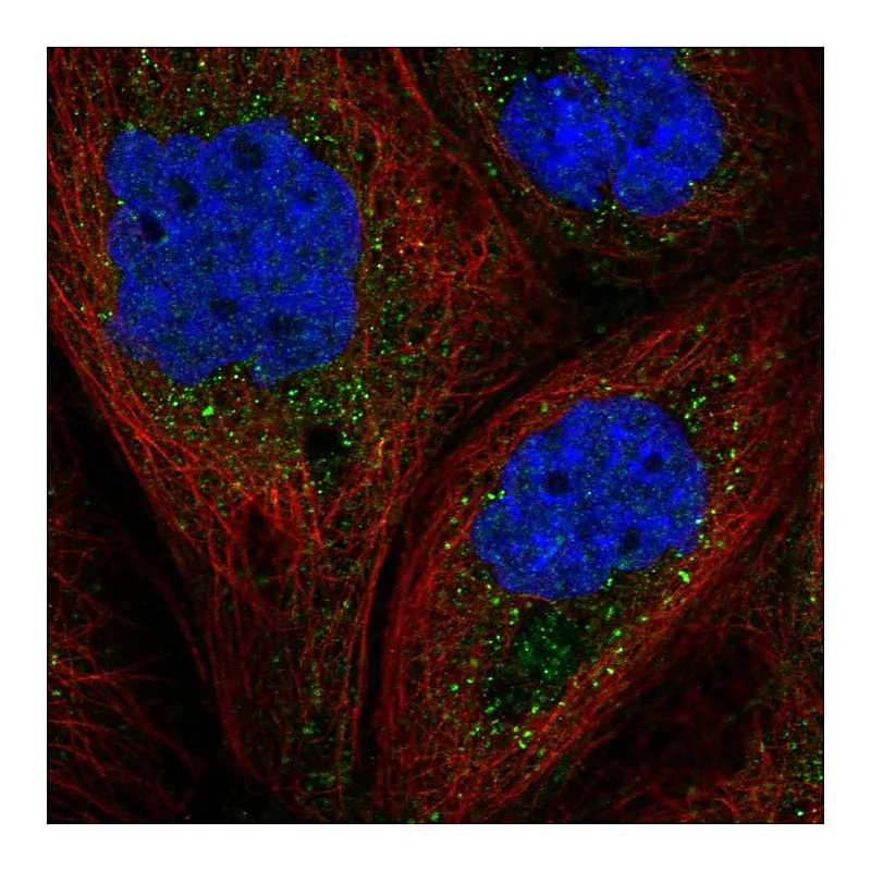 Atlas Antibodies Anti-GAB1 Antibody
