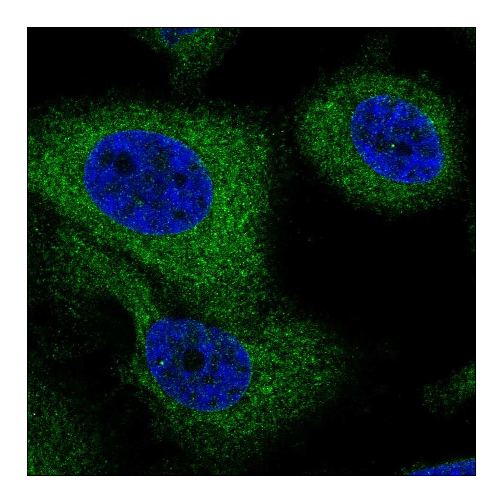 Atlas Antibodies Anti-G6PC3 Antibody