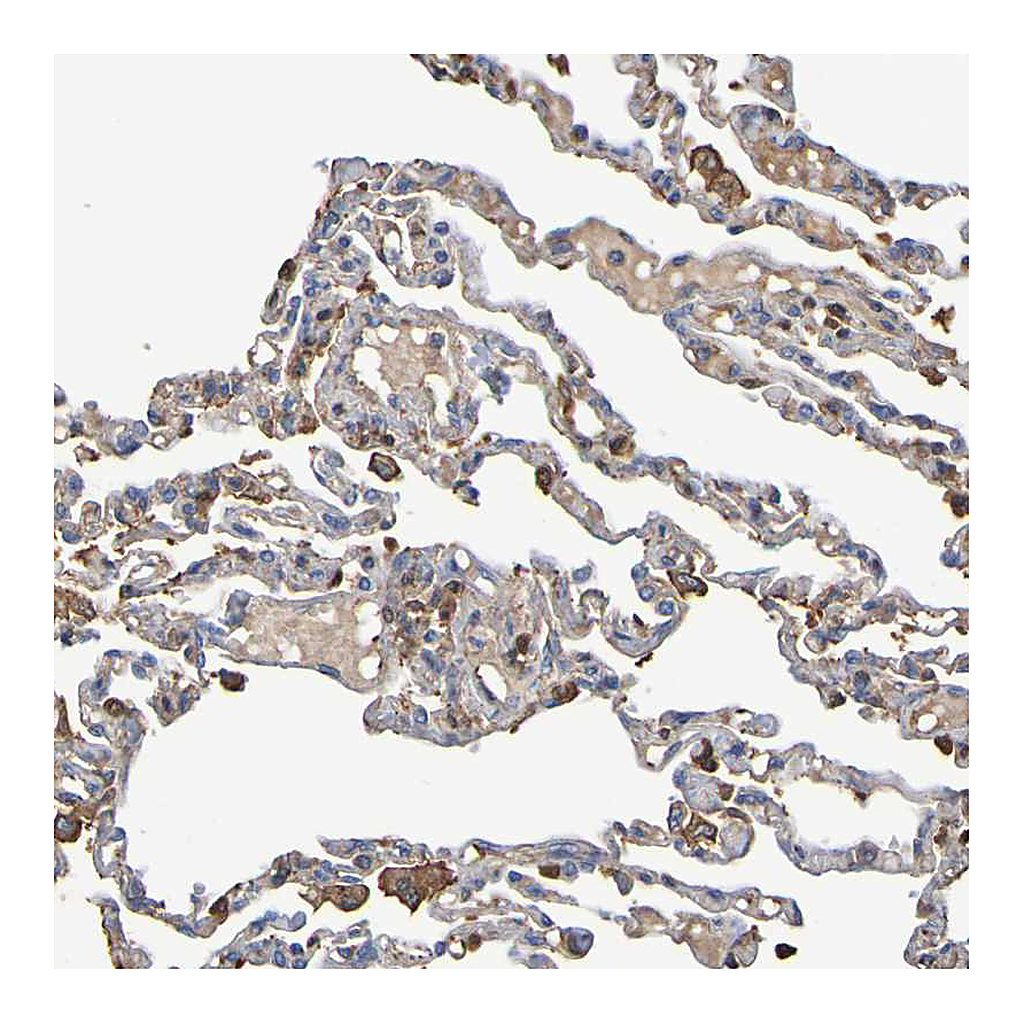 Atlas Antibodies Anti-GAB3 Antibody