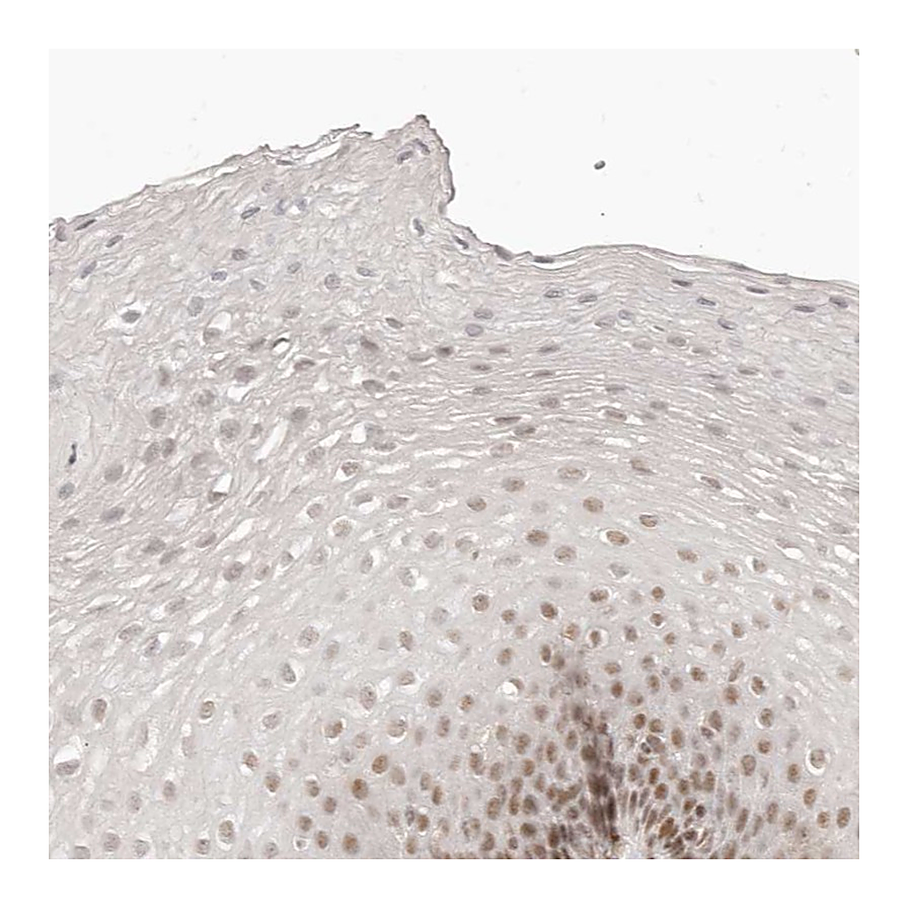 Atlas Antibodies Anti-GABPA Antibody