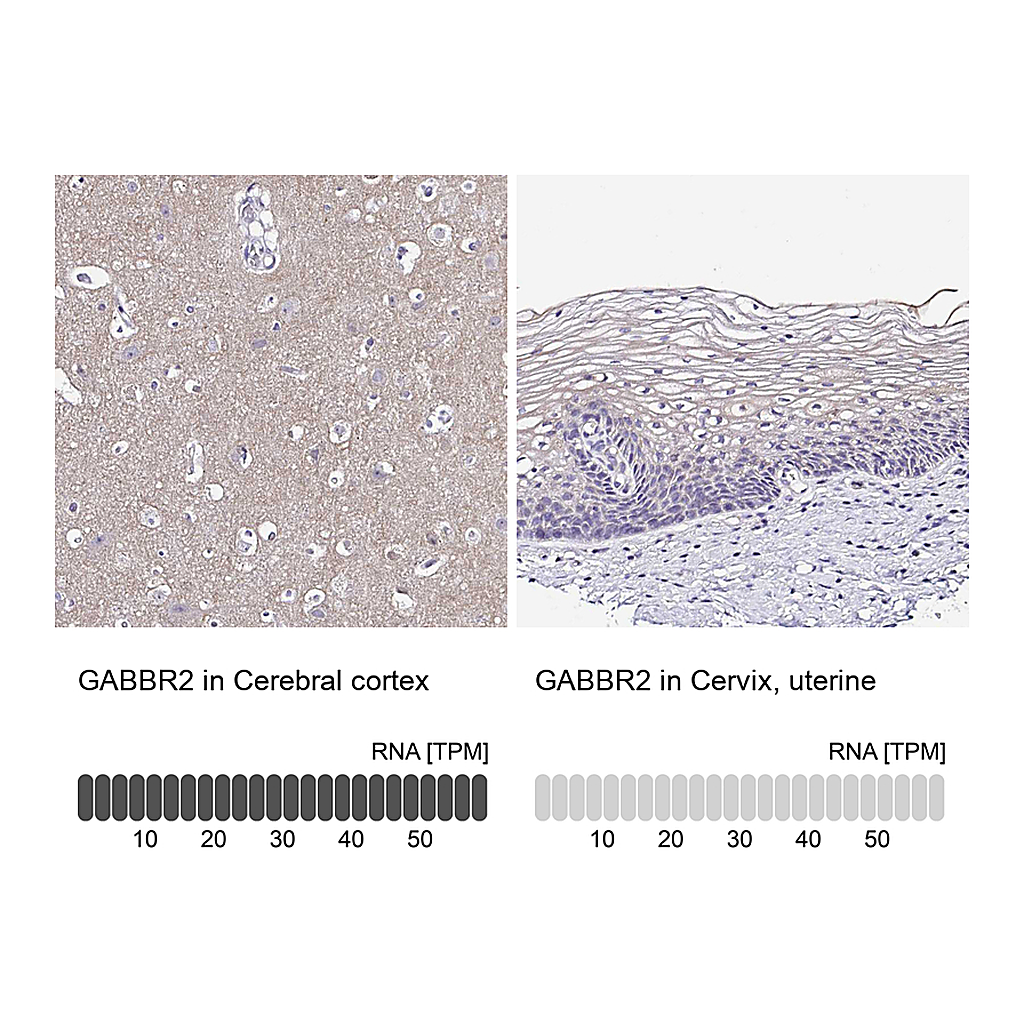 Atlas Antibodies Anti-GABBR2 Antibody