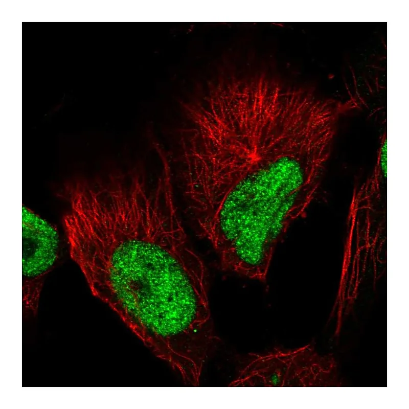 Atlas Antibodies Anti-GABPB1 Antibody