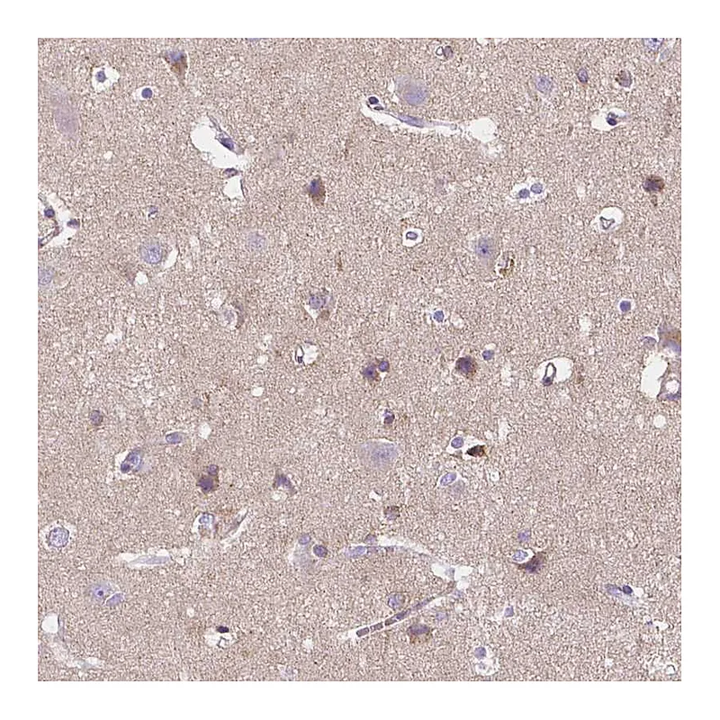Atlas Antibodies Anti-GABRD Antibody