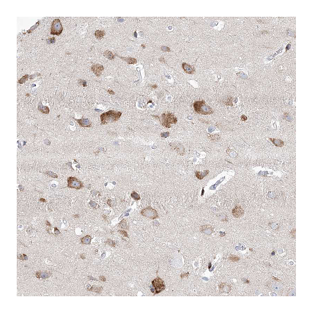 Atlas Antibodies Anti-GABRG1 Antibody