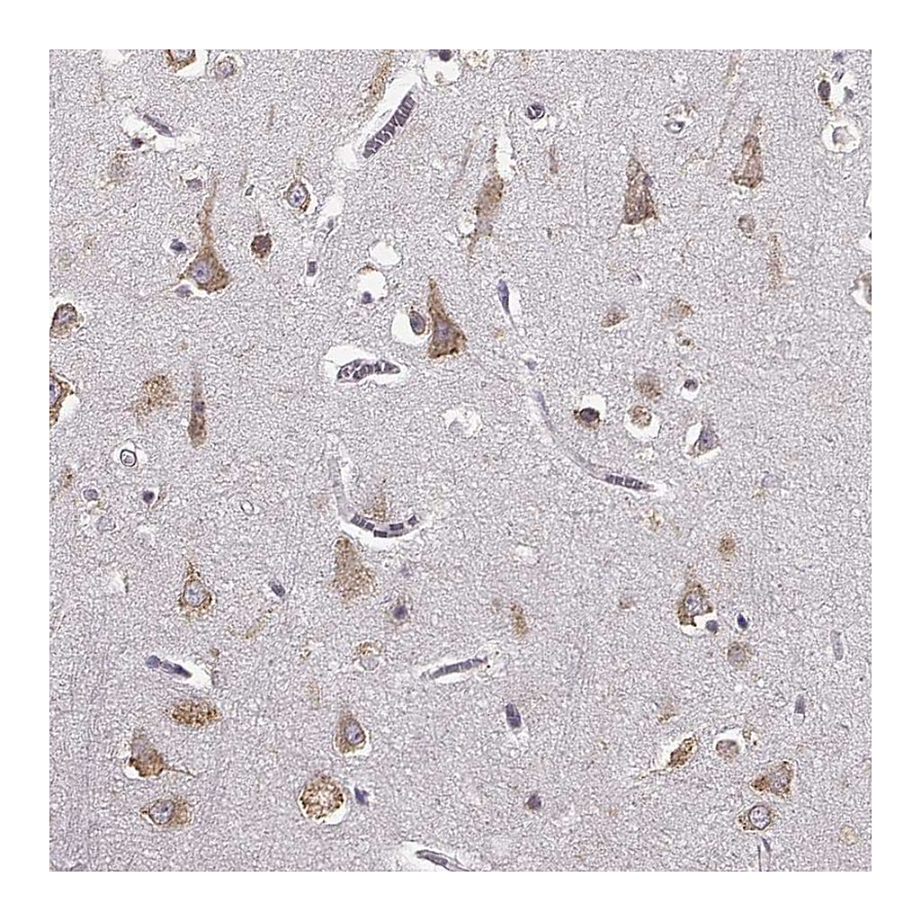 Atlas Antibodies Anti-GABRG3 Antibody