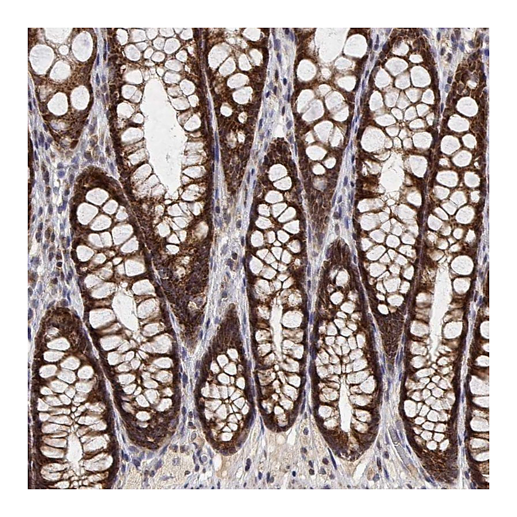Atlas Antibodies Anti-GADD45GIP1 Antibody