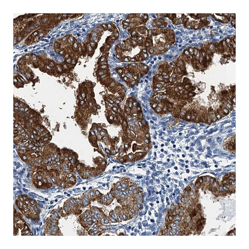 Atlas Antibodies Anti-GADL1 Antibody
