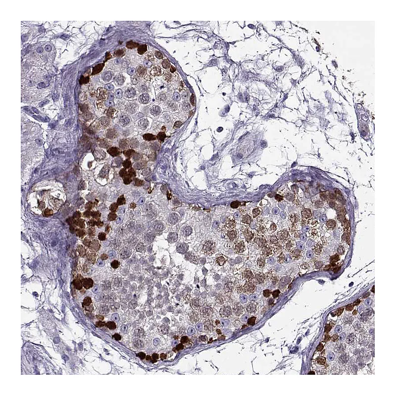 Atlas Antibodies Anti-GAGE1 Antibody