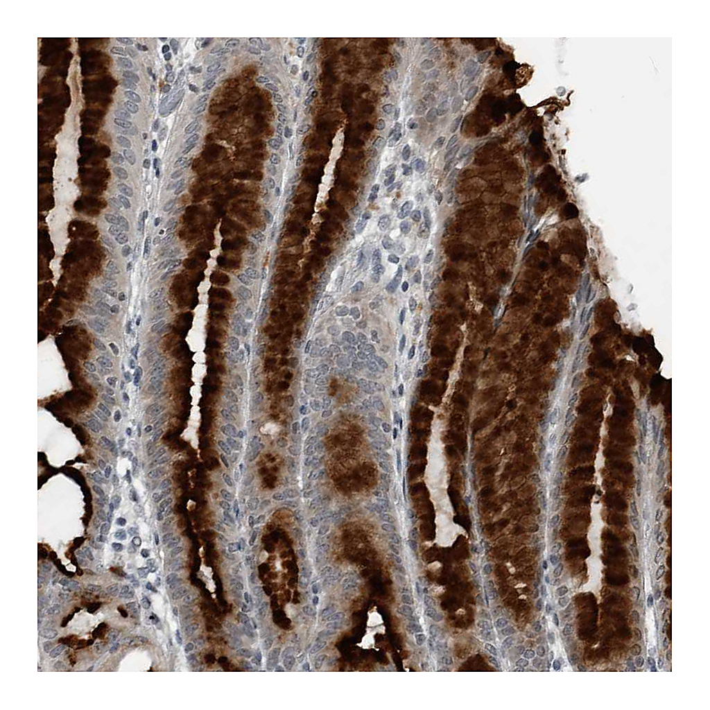 Atlas Antibodies Anti-GAK Antibody