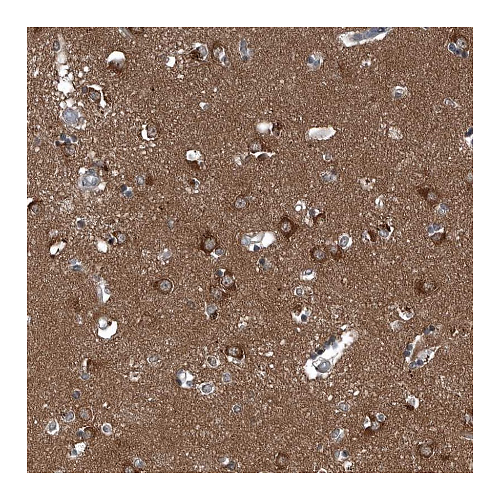 Atlas Antibodies Anti-GAK Antibody