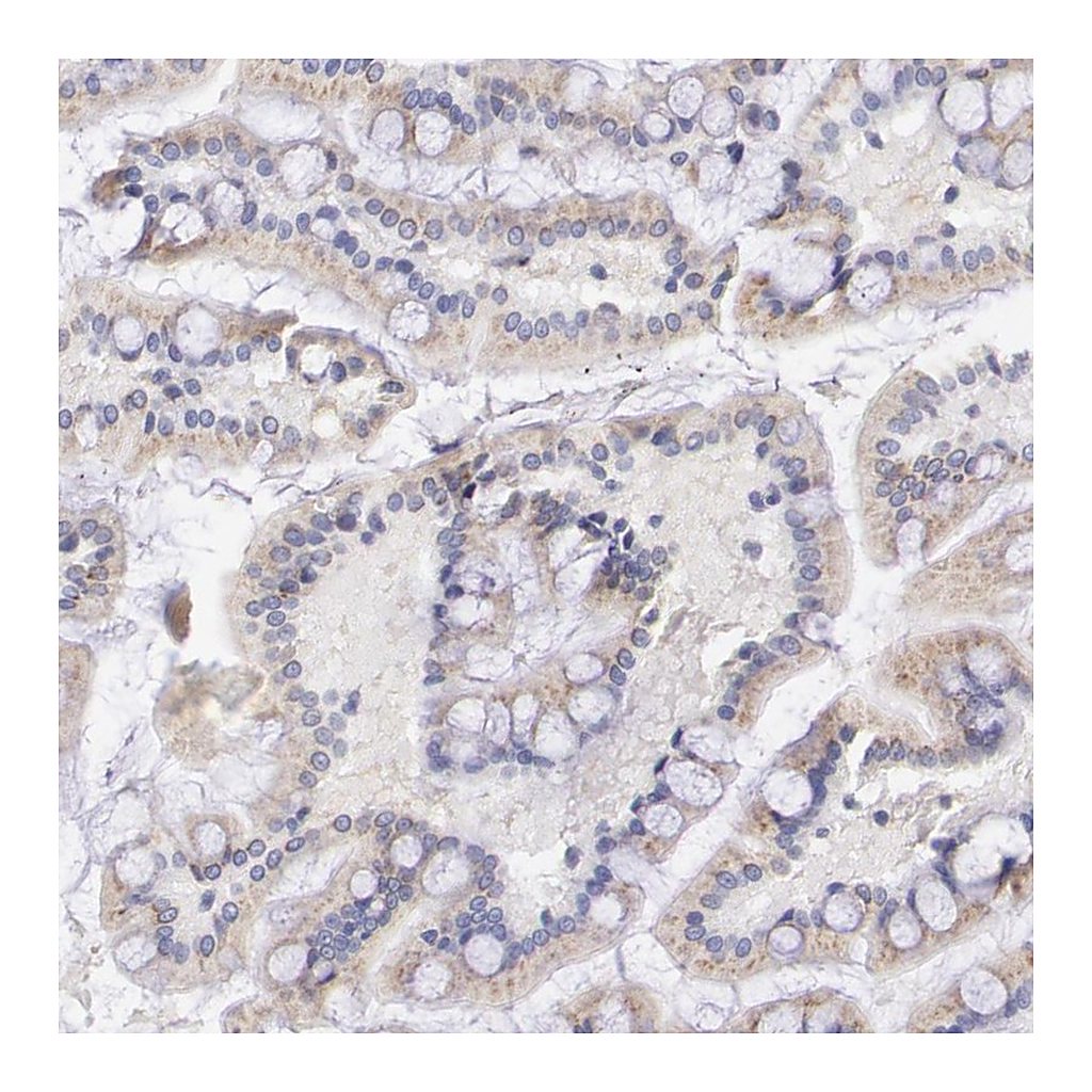 Atlas Antibodies Anti-GAL3ST1 Antibody