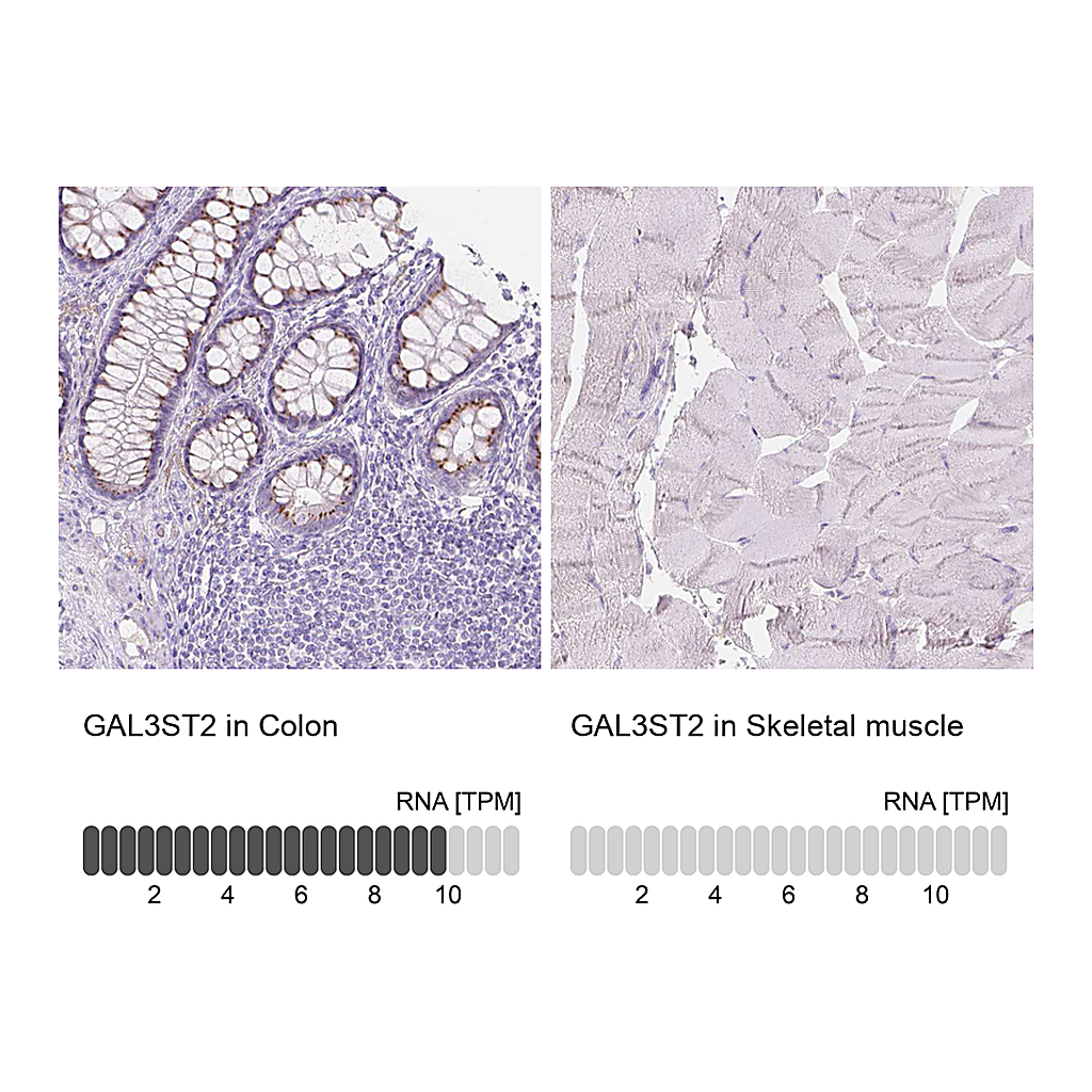 Atlas Antibodies Anti-GAL3ST2 Antibody