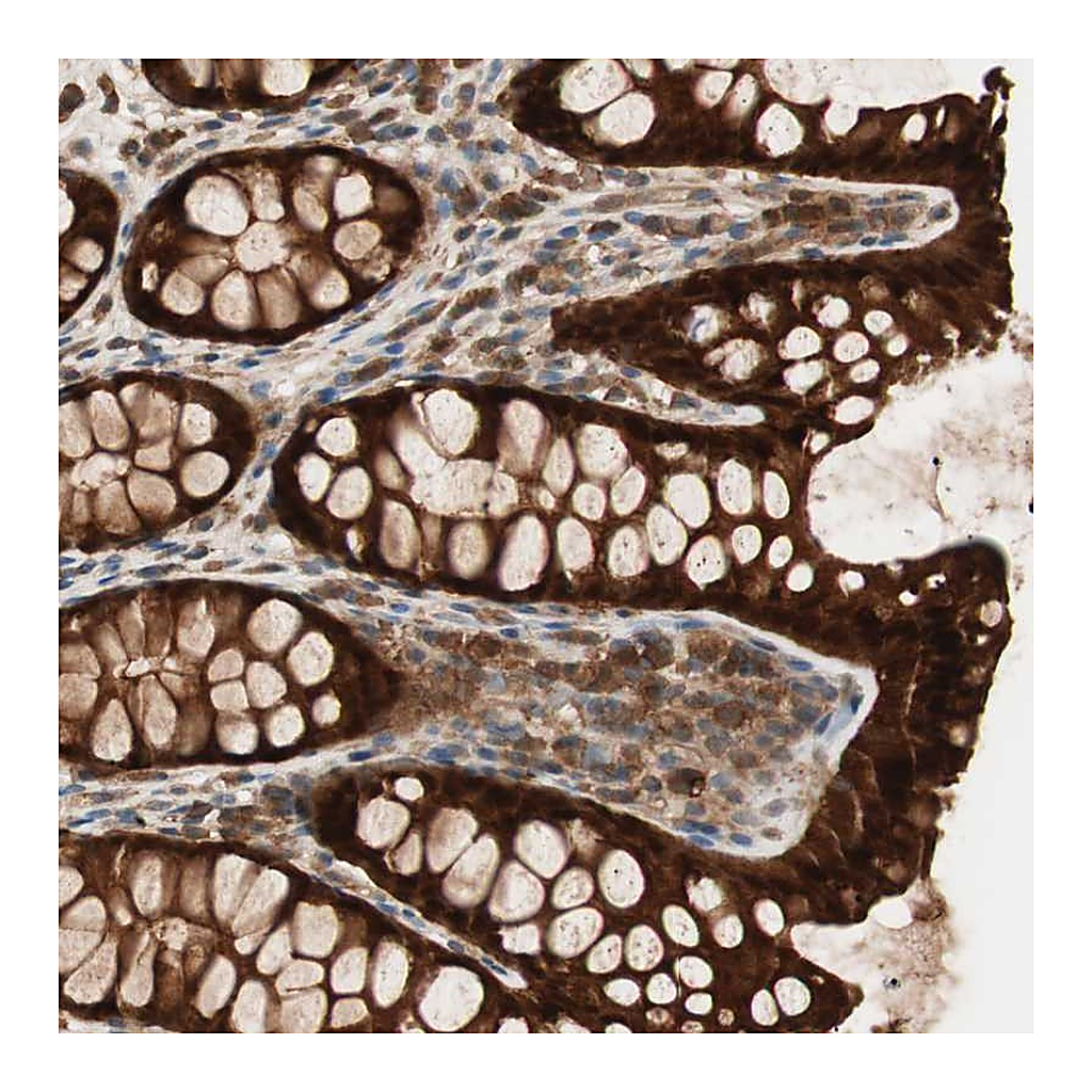 Atlas Antibodies Anti-GALE Antibody