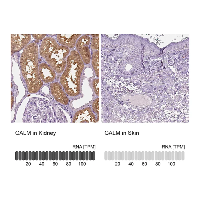 Atlas Antibodies Anti-GALM Antibody