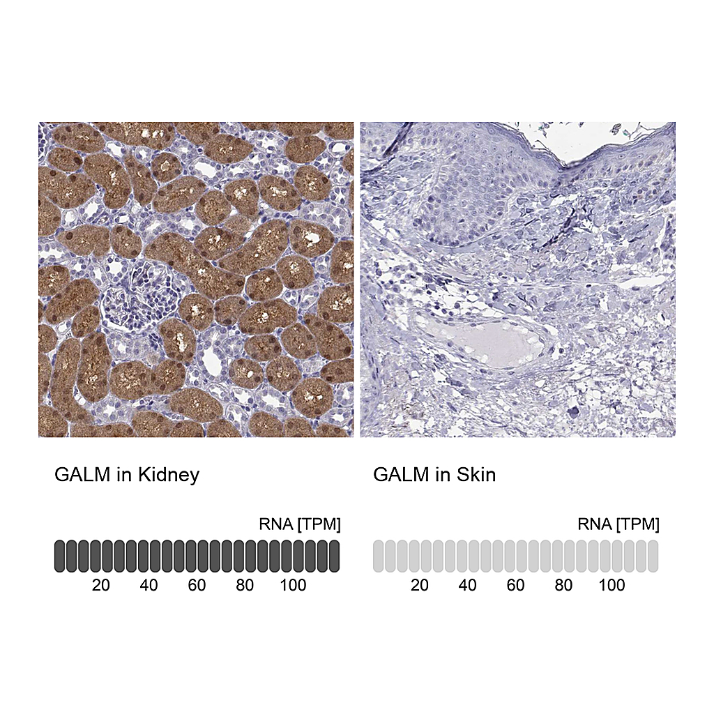 Atlas Antibodies Anti-GALM Antibody