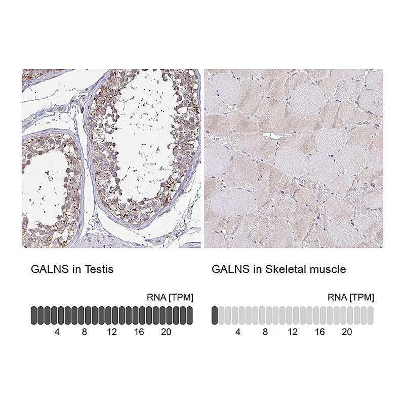 Atlas Antibodies Anti-GALNS Antibody