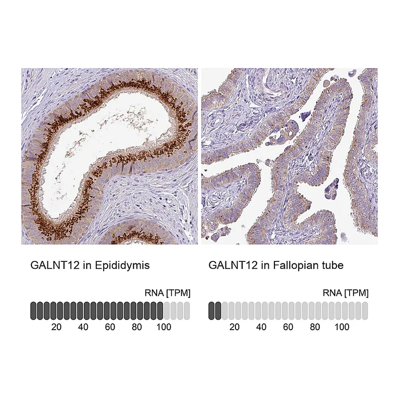 Atlas Antibodies Anti-GALNT12 Antibody