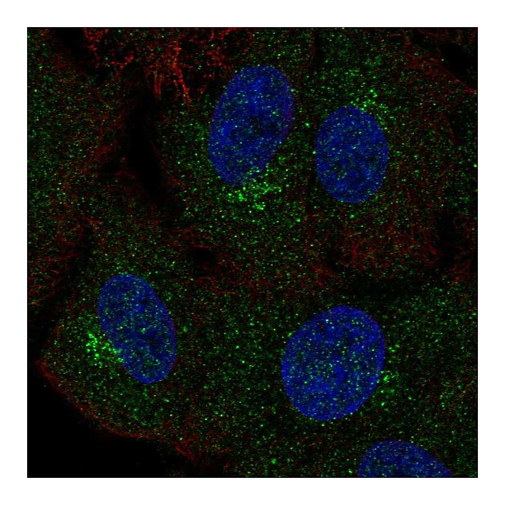 Atlas Antibodies Anti-GALNT4 Antibody