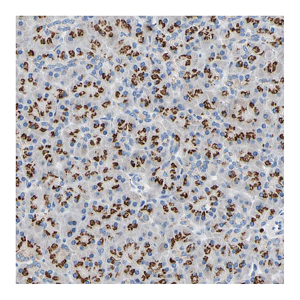 Atlas Antibodies Anti-GALNT2 Antibody