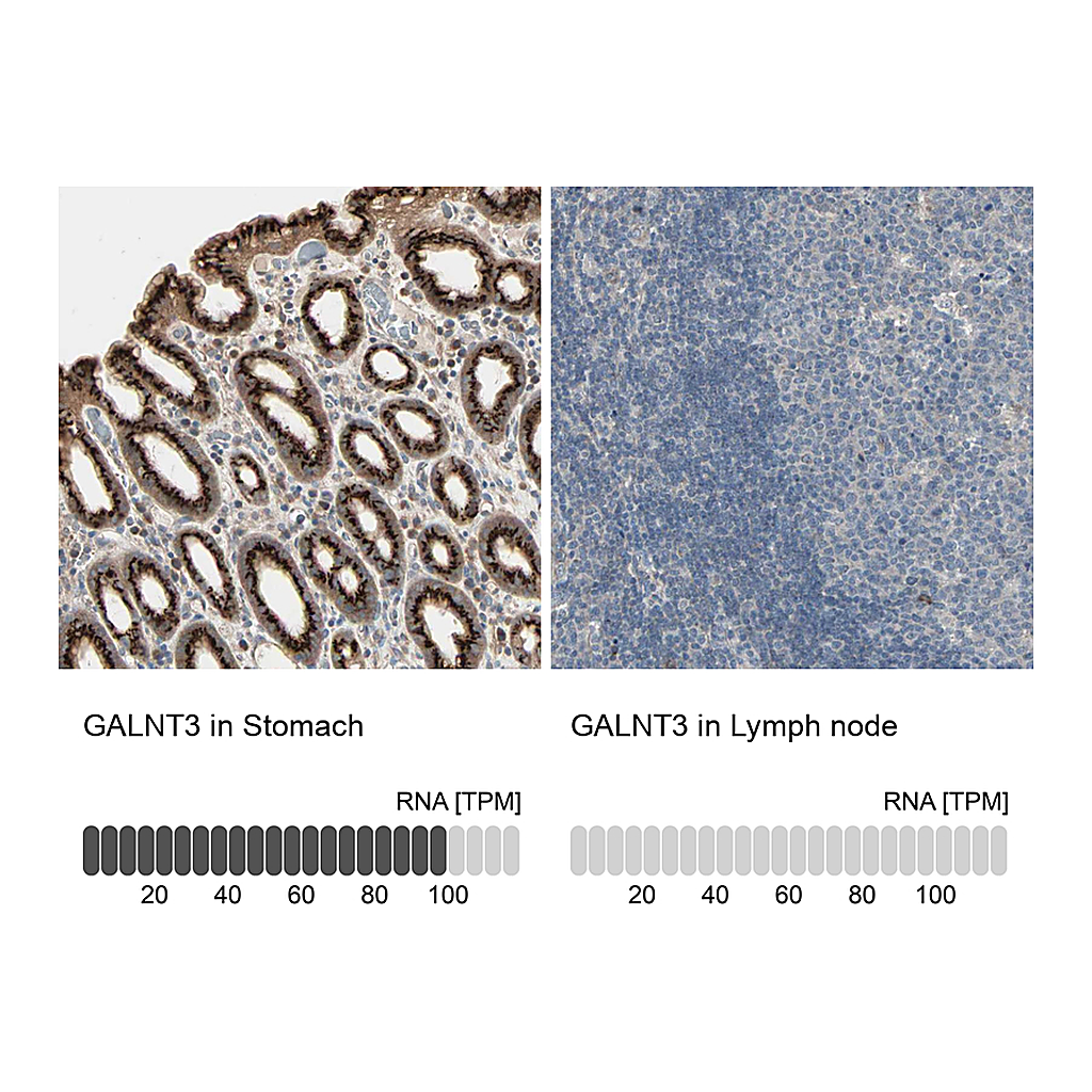 Atlas Antibodies Anti-GALNT3 Antibody