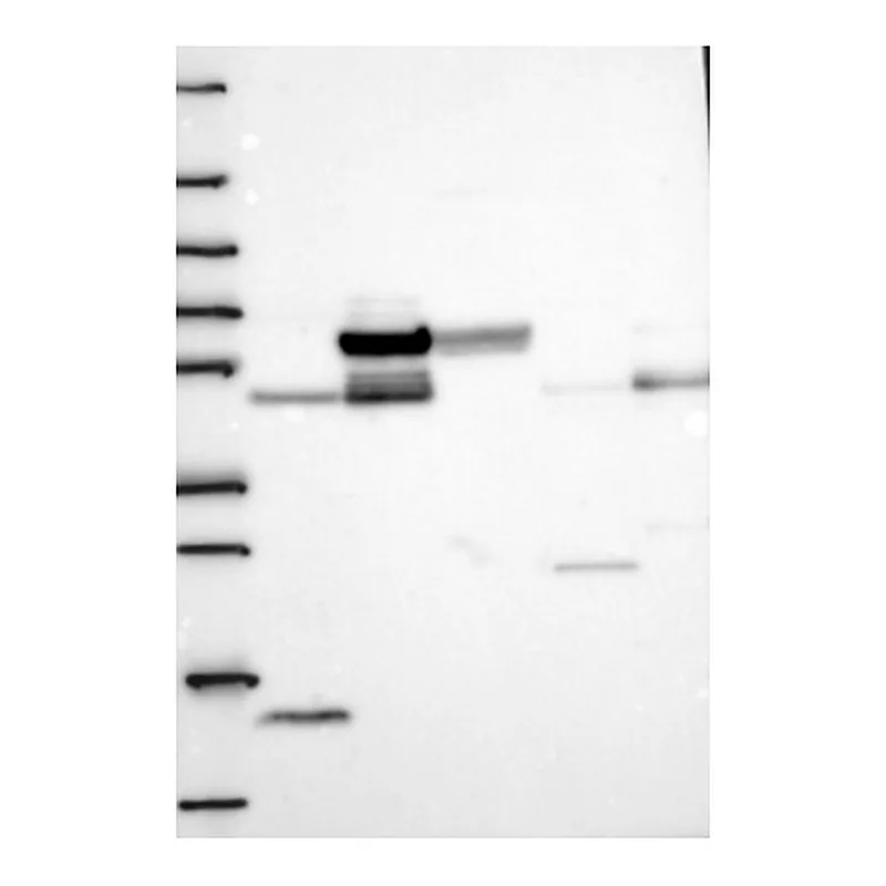 Atlas Antibodies Anti-GALNT16 Antibody