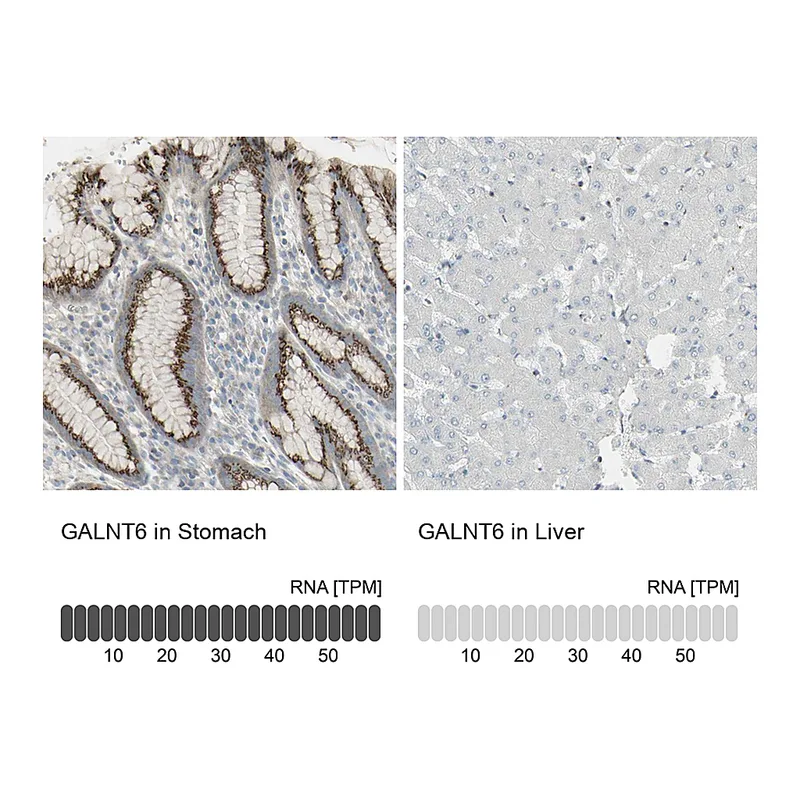 Atlas Antibodies Anti-GALNT6 Antibody