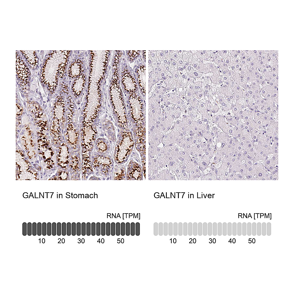 Atlas Antibodies Anti-GALNT7 Antibody