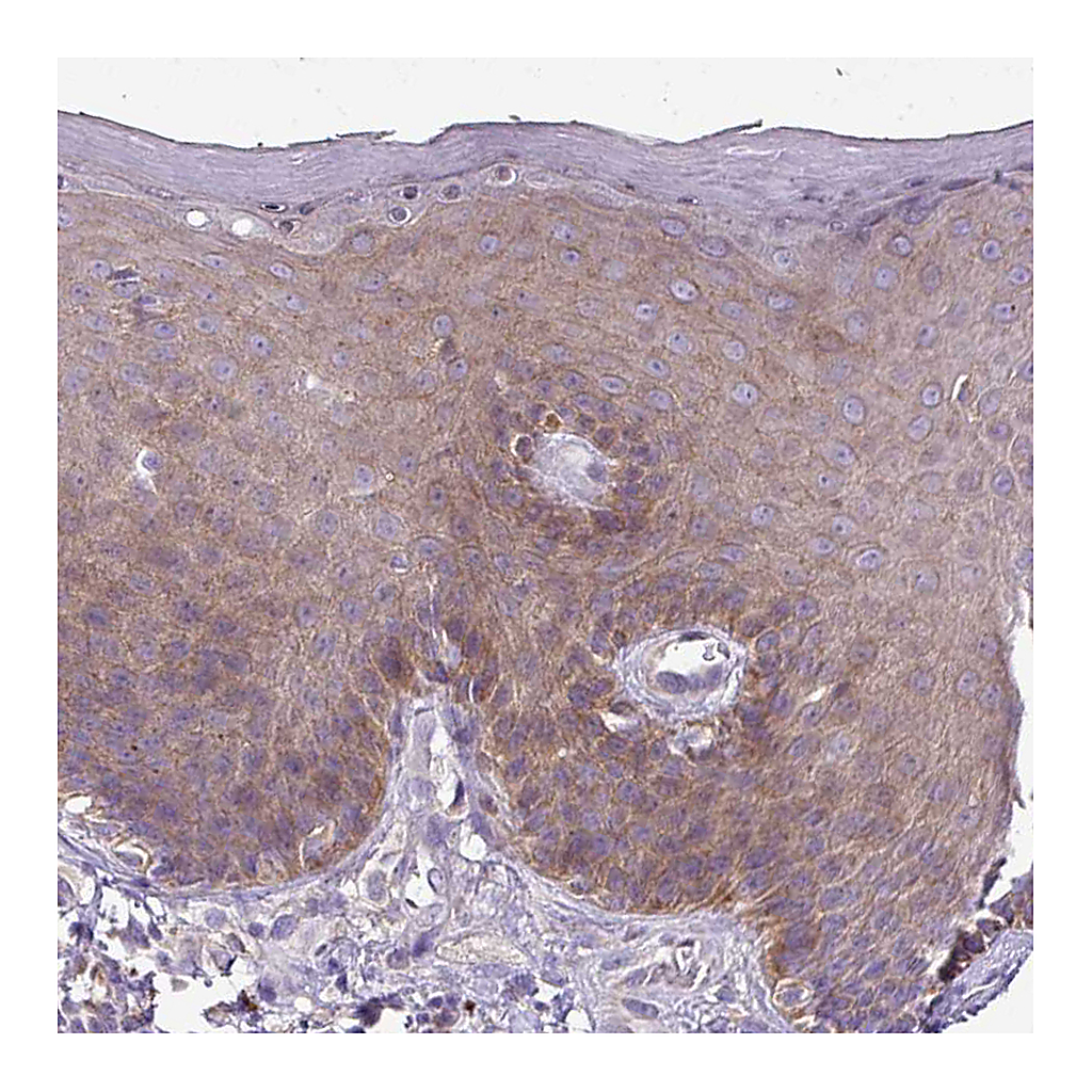 Atlas Antibodies Anti-GAN Antibody