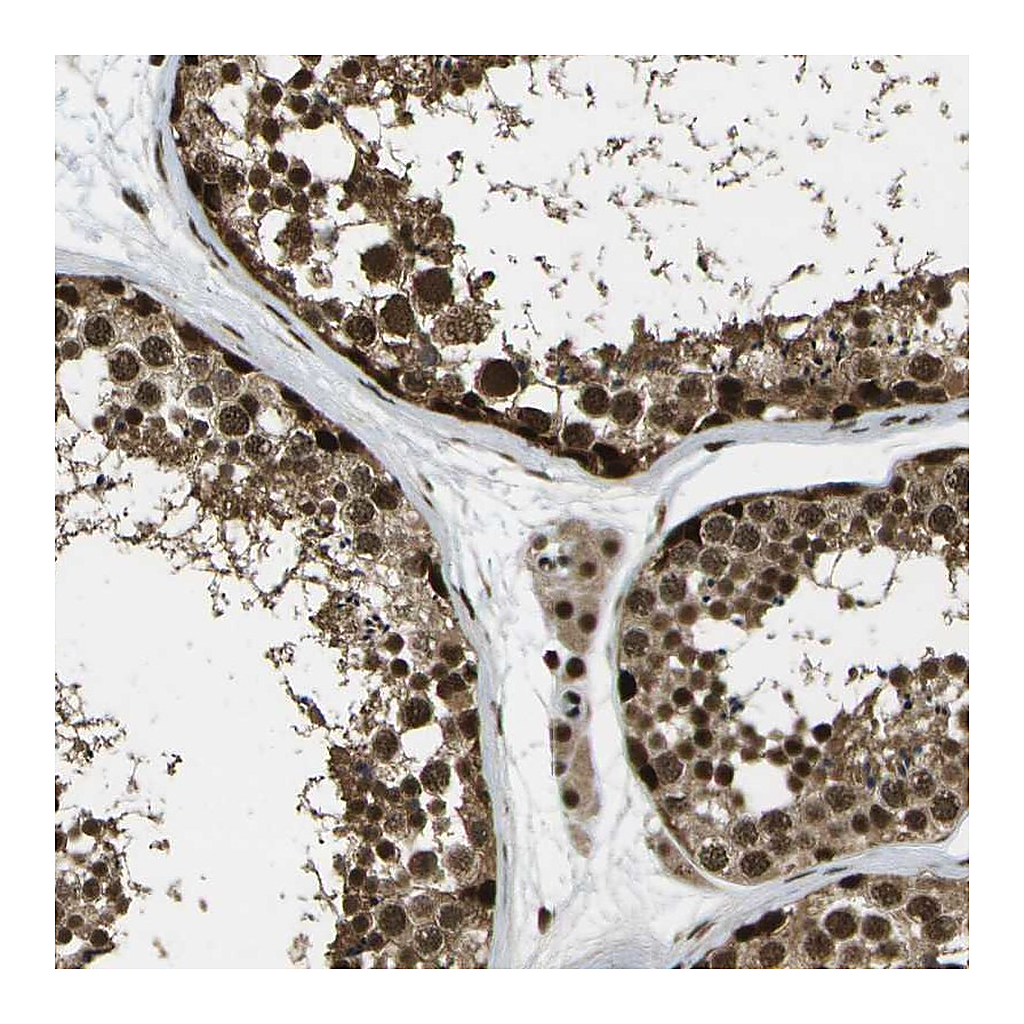 Atlas Antibodies Anti-GANC Antibody