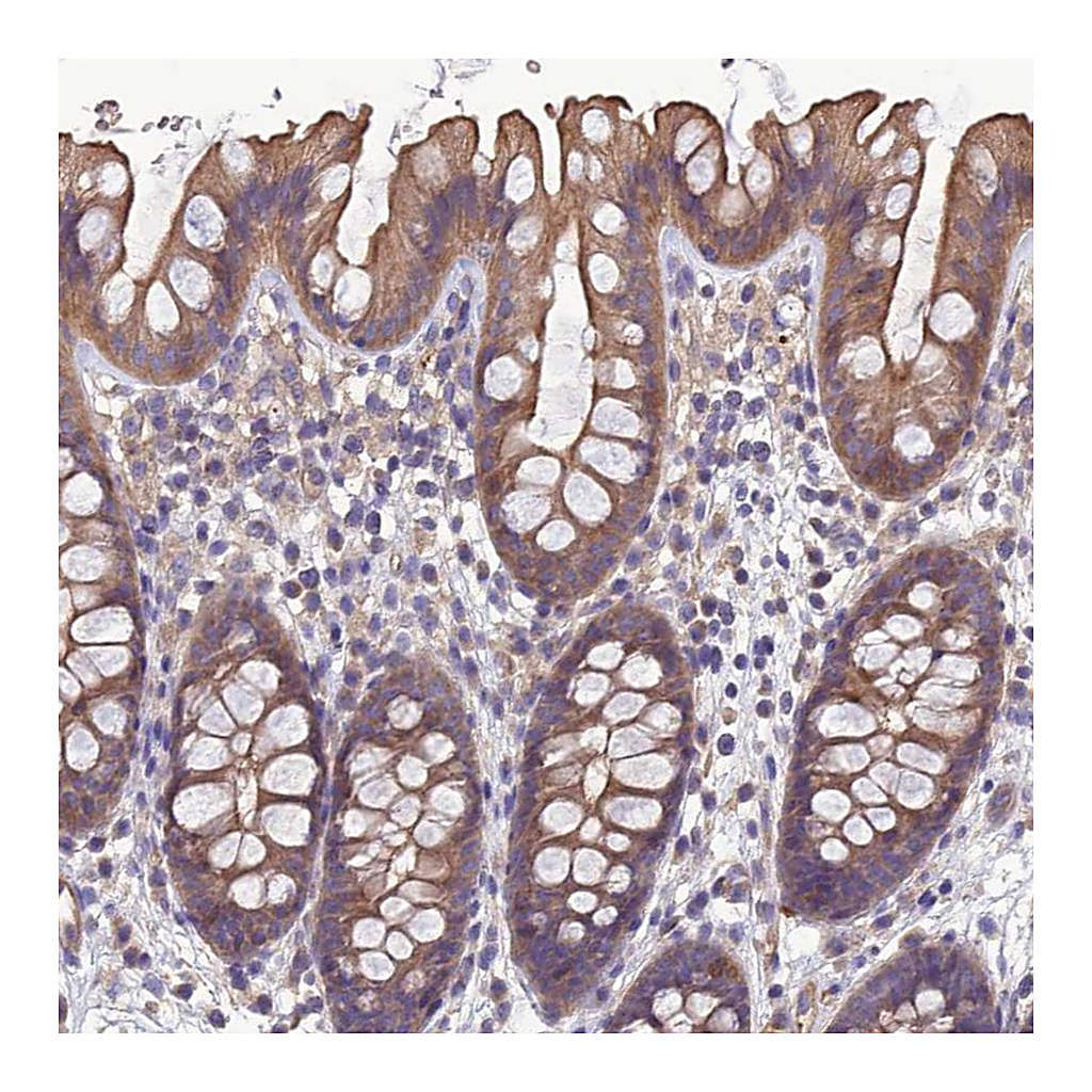 Atlas Antibodies Anti-GALR2 Antibody