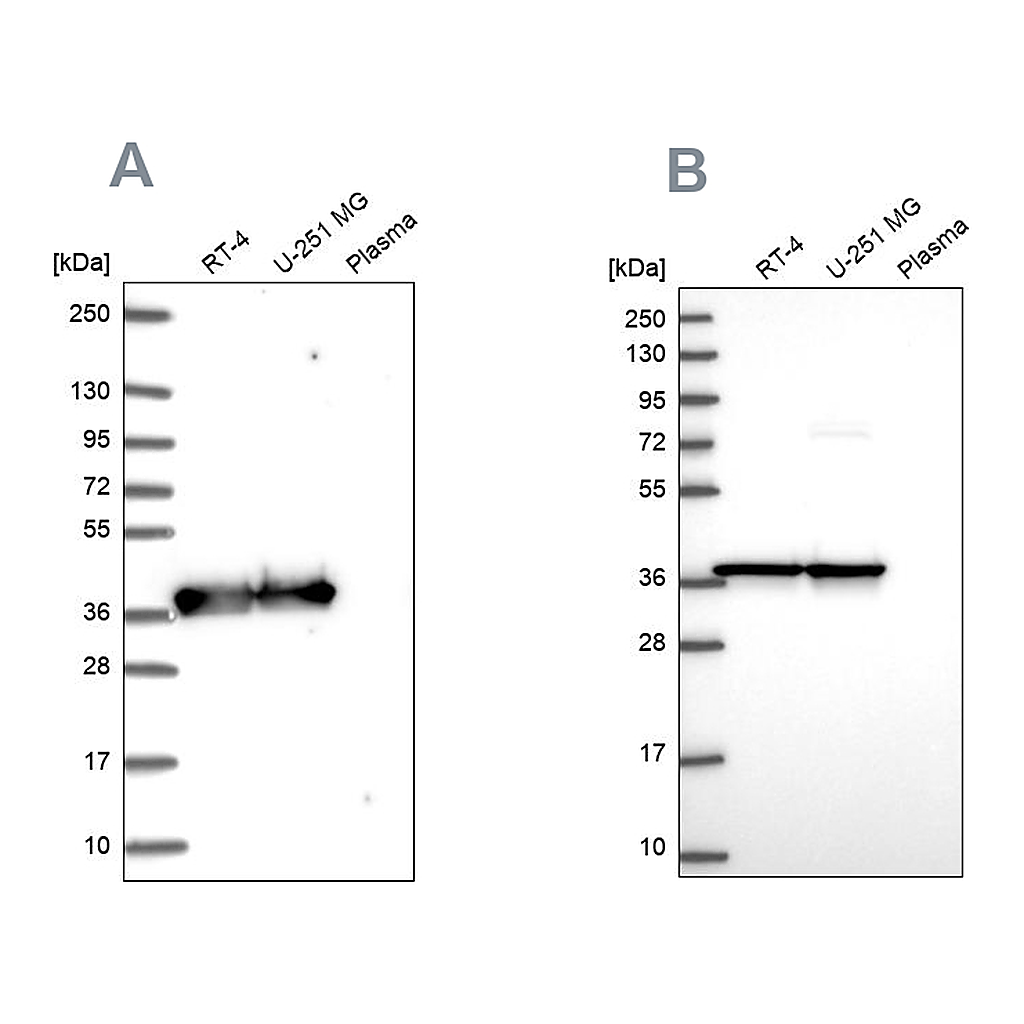 Atlas Antibodies Anti-GAPDH Antibody