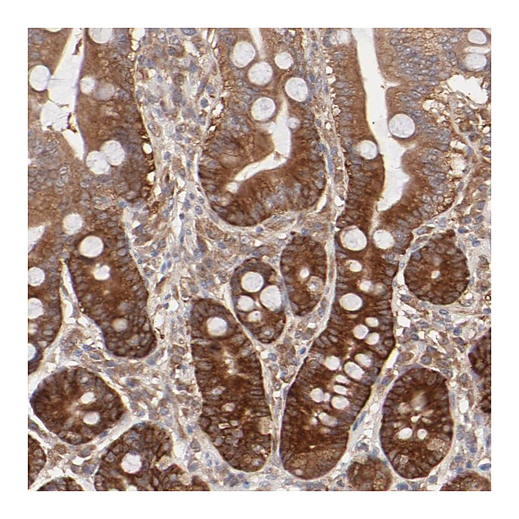 Atlas Antibodies Anti-GART Antibody