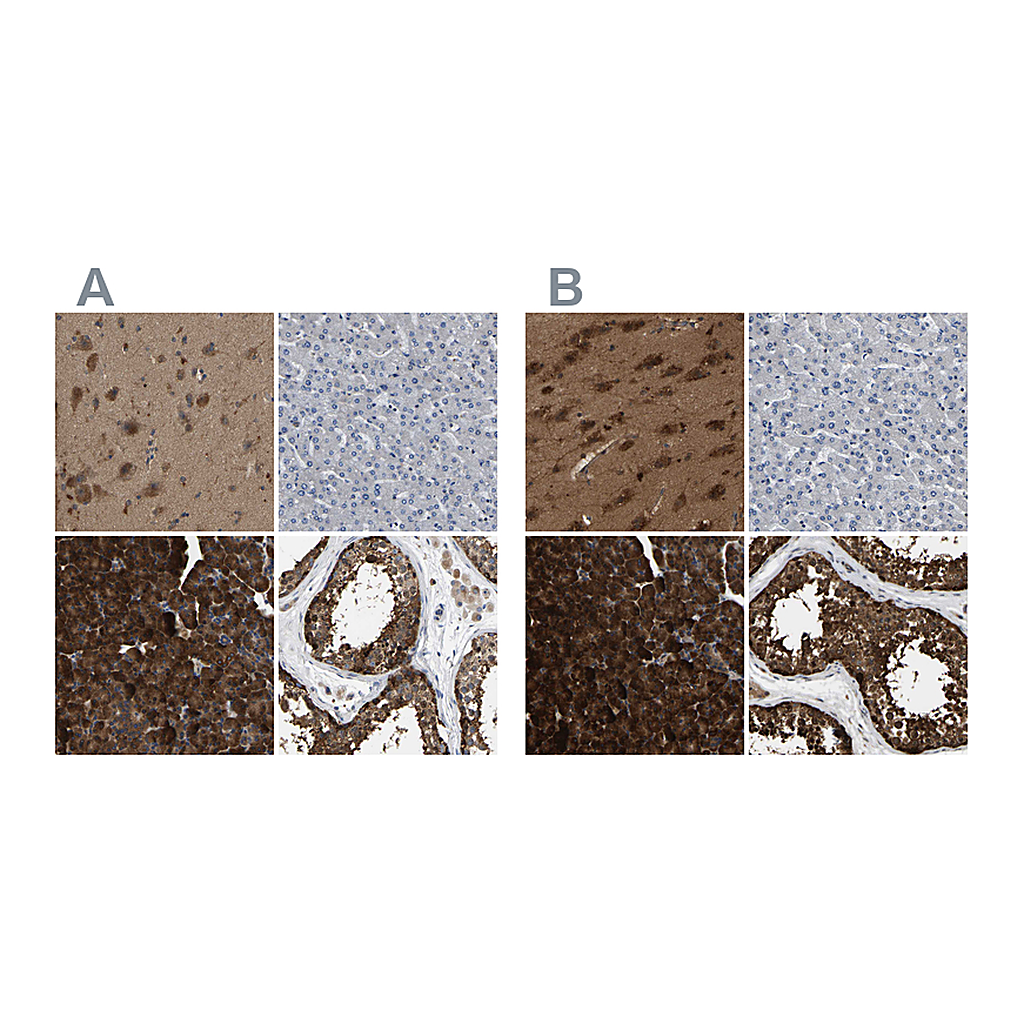 Atlas Antibodies Anti-GARS Antibody