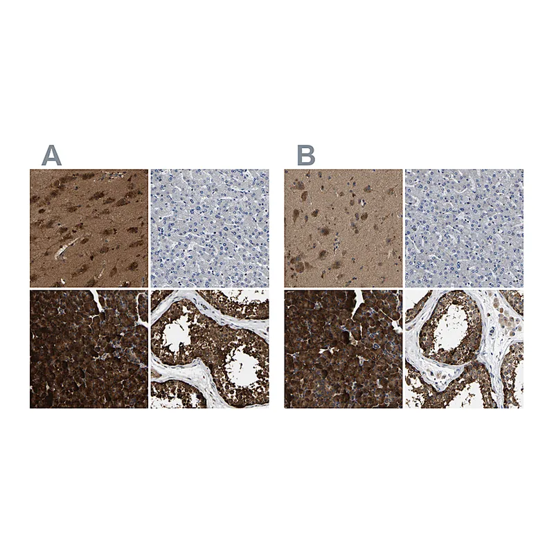 Atlas Antibodies Anti-GARS Antibody