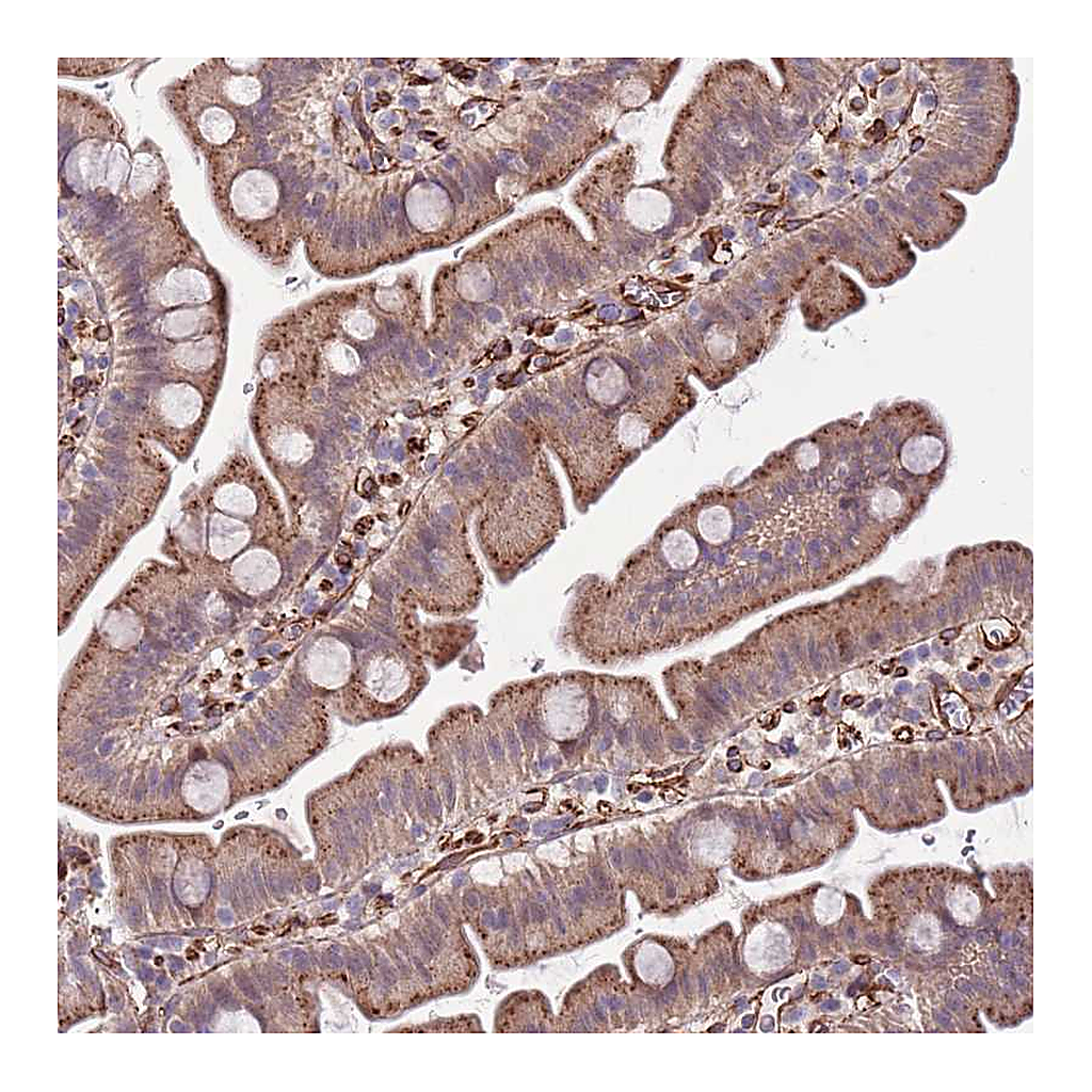 Atlas Antibodies Anti-GAS2L3 Antibody
