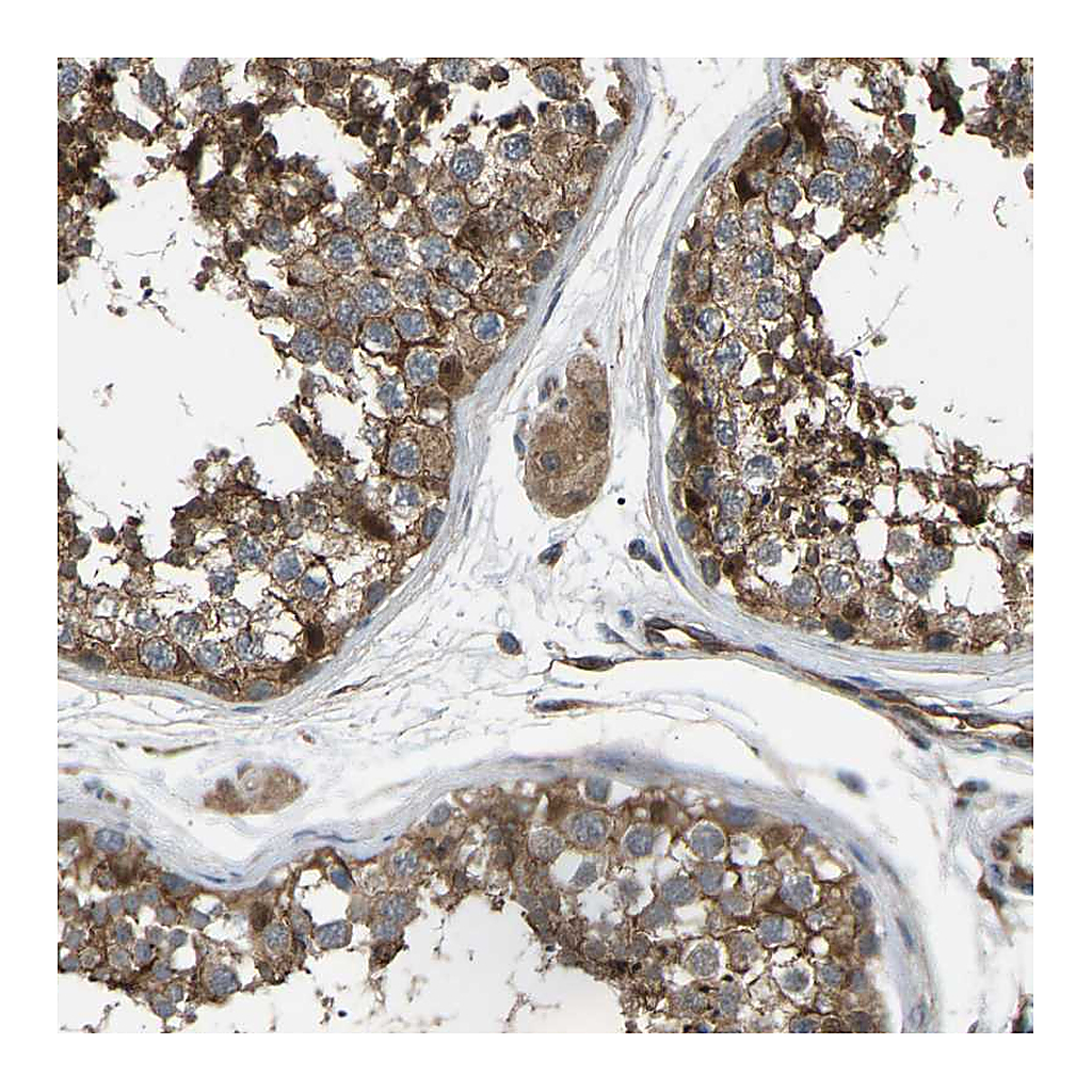 Atlas Antibodies Anti-GAS2L1 Antibody