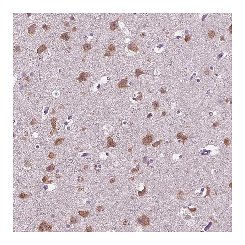 Atlas Antibodies Anti-GAS7 Antibody