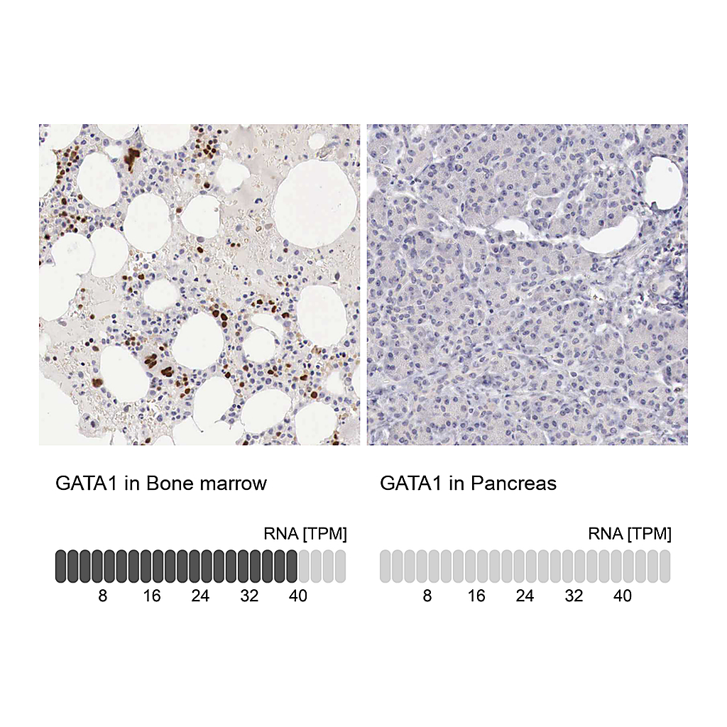 Atlas Antibodies Anti-GATA1 Antibody