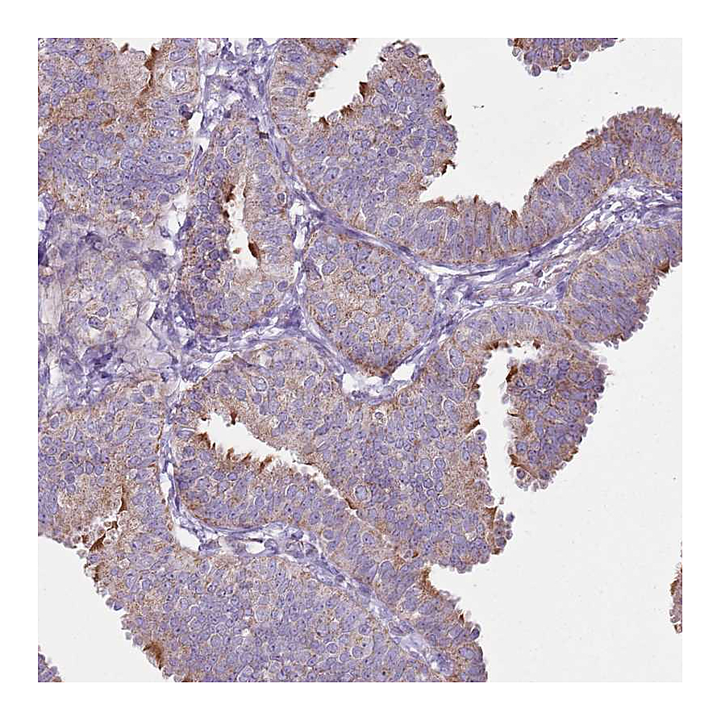 Atlas Antibodies Anti-GAS8 Antibody