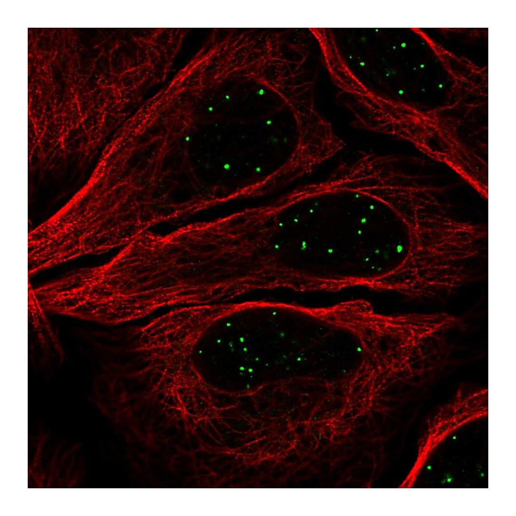 Atlas Antibodies Anti-GATA4 Antibody