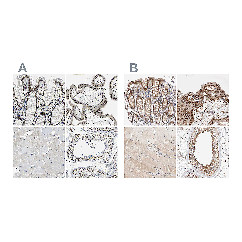 Atlas Antibodies Anti-GATAD2A Antibody